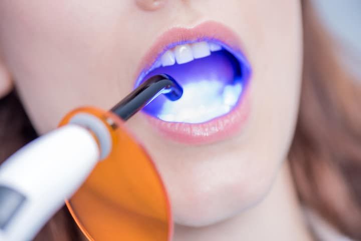 A woman undergoing dental treatment with a blue LED light and protective glasses.